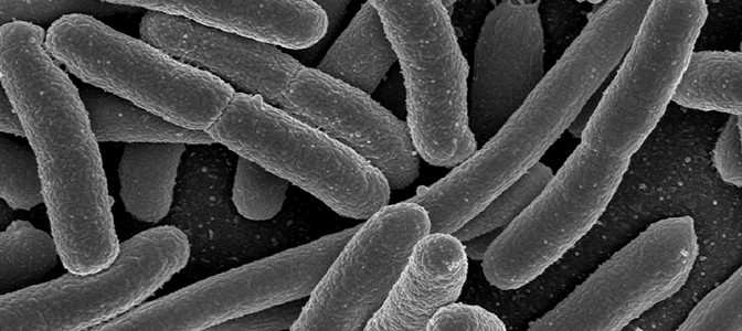 ‘We can still contain this superbug’