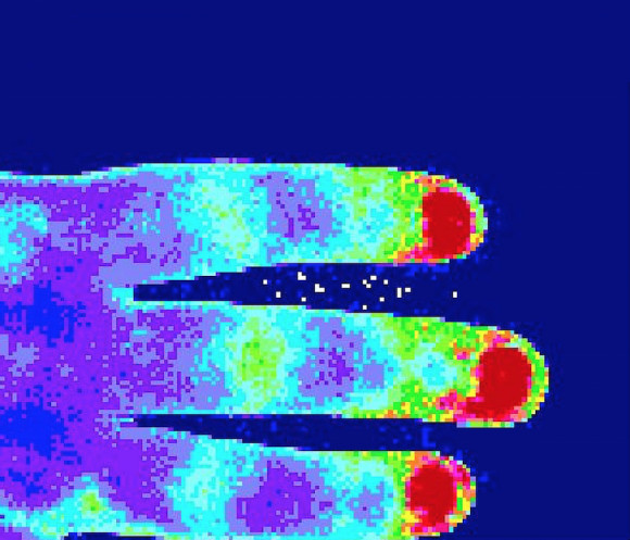 laser speckle image of a hand